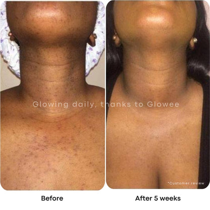 Glow Pads - Turmeric & Kojic