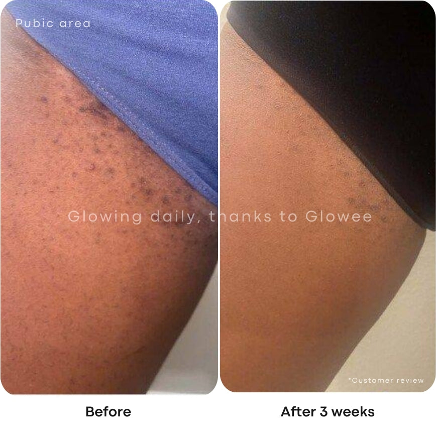 Glow Pads - Turmeric & Kojic